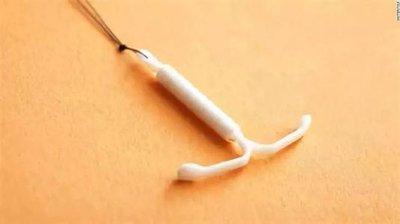 Mirena IUD for Adenomyosis: Is It Possible For Every Patient
