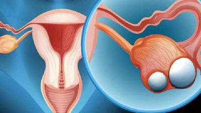 Can Fallopian Tubes Be Naturally Blocked?