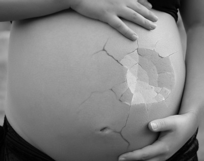 Can Miscarriage Cause Endometriosis?