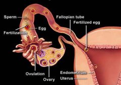 How tubal blockage and hydrosalpinx affect your fertility?