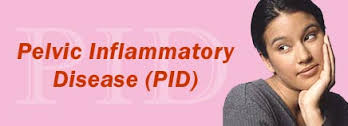 pelvic inflammatory disease