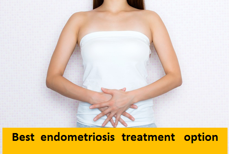 best endometriosis treatment option 