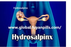 What risks can hydrosalpinx cause?