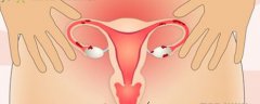 Can Abortion Cause Endometriosis?