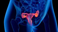 Fuyan Pill: A Specific Drug for Pelvic Inflammatory Disease