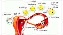 How is Hydrosalpinx formed