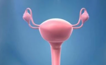 tubal infertility