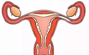 Why Do Your Fallopian Tubes Get Inflamed?
