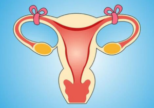 Blocked Fallopian Tube Needs To Be Checked As Soon As Possible