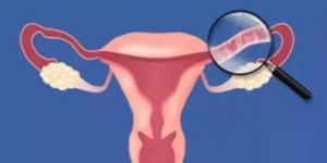 These Four Methods Are More Accurate When Checking For Blocked Fallopian Tubes