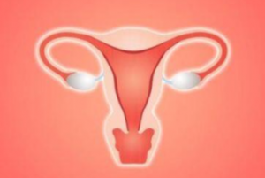 Endometriosis: An Intricate Problem In Females