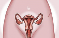 Stay Away From These Bad Habits That Can Lead To Blocked Fallopian Tubes