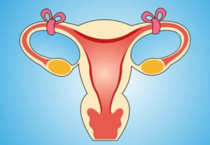 Which Fallopian Tube Lesions Can Cause Tubal Blockage?