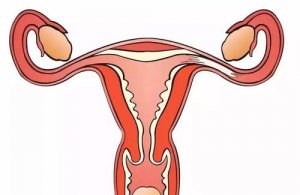 Patients With Blocked Fallopian Tubes Should Sleep On Their Side