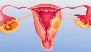 Knowledge About Cause And Treatment Of Blocked Fallopian Tubes