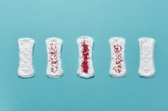 Is Irregular Menstruation Related to Hydrosalpinx?