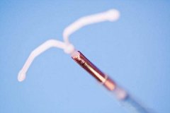 Can You Install an IUD If You Have Adenomyosis?