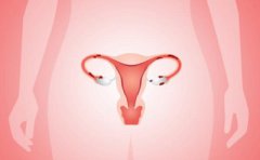 Can I Only Remove Fallopian Tubes with Hydrosalpinx? TCM Helps Get Pregnant!